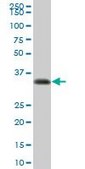 Anti-HLA-DRA antibody produced in mouse purified immunoglobulin, buffered aqueous solution