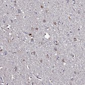 Anti-TK2 antibody produced in rabbit Prestige Antibodies&#174; Powered by Atlas Antibodies, affinity isolated antibody, buffered aqueous glycerol solution