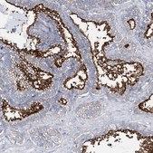 Anti-ANO1 antibody produced in rabbit Prestige Antibodies&#174; Powered by Atlas Antibodies, affinity isolated antibody, buffered aqueous glycerol solution