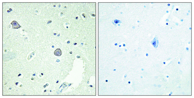 Anti-DRD1 antibody produced in rabbit affinity isolated antibody