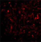 Anti-RAP80 (ab2) antibody produced in rabbit affinity isolated antibody, buffered aqueous solution