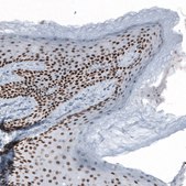 Anti-GRHL2 antibody produced in rabbit Prestige Antibodies&#174; Powered by Atlas Antibodies, affinity isolated antibody, buffered aqueous glycerol solution