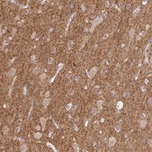 Anti-DBN1 antibody produced in rabbit Prestige Antibodies&#174; Powered by Atlas Antibodies, affinity isolated antibody, buffered aqueous glycerol solution