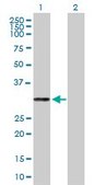 Anti-PRTN3 antibody produced in mouse purified immunoglobulin, buffered aqueous solution