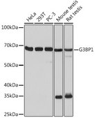 Anti-G3BP1 Antibody, clone 5A4T0, Rabbit Monoclonal