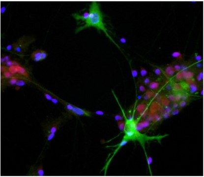 Anti-Aldolase C Antibody, C-Term, clone 1A1 clone 1A1, from mouse