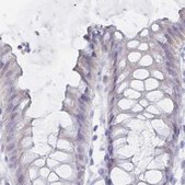 Anti-IMPG1 antibody produced in rabbit Prestige Antibodies&#174; Powered by Atlas Antibodies, affinity isolated antibody