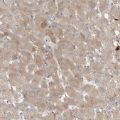 Anti-CFI antibody produced in rabbit Prestige Antibodies&#174; Powered by Atlas Antibodies, affinity isolated antibody, buffered aqueous glycerol solution