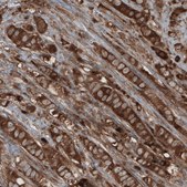 Monoclonal Anti-CARS antibody produced in mouse Prestige Antibodies&#174; Powered by Atlas Antibodies, clone CL2310, purified immunoglobulin, buffered aqueous glycerol solution
