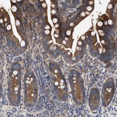 Anti-CDKN2C antibody produced in rabbit Prestige Antibodies&#174; Powered by Atlas Antibodies, affinity isolated antibody, buffered aqueous glycerol solution