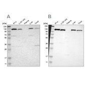 Anti-PITRM1 antibody produced in rabbit Ab1, Prestige Antibodies&#174; Powered by Atlas Antibodies, affinity isolated antibody, buffered aqueous glycerol solution