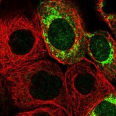 Anti-MRPS7 antibody produced in rabbit Prestige Antibodies&#174; Powered by Atlas Antibodies, affinity isolated antibody, buffered aqueous glycerol solution, Ab1