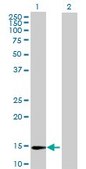 Anti-ZNF593 antibody produced in mouse purified immunoglobulin, buffered aqueous solution