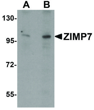 Anti-ZIMP7 antibody produced in rabbit affinity isolated antibody