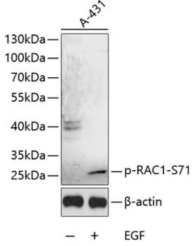 Anti-Phospho-RAC1-S71 antibody produced in rabbit