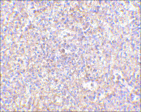 Anti-STEAP1 (ab1) antibody produced in rabbit affinity isolated antibody, buffered aqueous solution