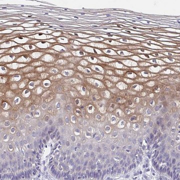 Anti-CDC42BPG antibody produced in rabbit Prestige Antibodies&#174; Powered by Atlas Antibodies, affinity isolated antibody, buffered aqueous glycerol solution