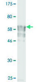 Monoclonal Anti-IL11RA antibody produced in mouse clone 3D4-G4, purified immunoglobulin, buffered aqueous solution