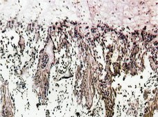 Anti-Bone Sialoprotein II Antibody, CT, clone ID1.2 clone ID1.2, Chemicon&#174;, from mouse