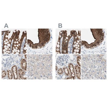 Anti-VIL1 antibody produced in rabbit Ab2, Prestige Antibodies&#174; Powered by Atlas Antibodies, affinity isolated antibody, buffered aqueous glycerol solution