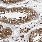 Anti-SERPINB6 antibody produced in rabbit Prestige Antibodies&#174; Powered by Atlas Antibodies, affinity isolated antibody, buffered aqueous glycerol solution