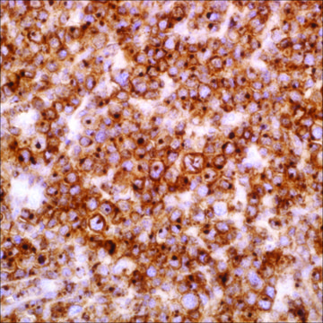 CD2 (EP222) Rabbit Monoclonal Primary Antibody