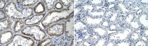 Anti-TRPV1 Antibody, clone 1N19 ZooMAb&#174; Rabbit Monoclonal recombinant, expressed in HEK 293 cells