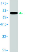 Monoclonal Anti-FASN antibody produced in mouse clone 3F2-1F3, purified immunoglobulin, buffered aqueous solution