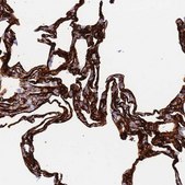Anti-CAV2 antibody produced in rabbit Prestige Antibodies&#174; Powered by Atlas Antibodies, affinity isolated antibody, buffered aqueous glycerol solution