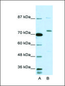 Anti-EXOSC10 antibody produced in rabbit IgG fraction of antiserum