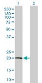 Anti-VHL antibody produced in mouse purified immunoglobulin, buffered aqueous solution