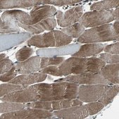Anti-RAB7A antibody produced in rabbit Prestige Antibodies&#174; Powered by Atlas Antibodies, affinity isolated antibody, buffered aqueous glycerol solution