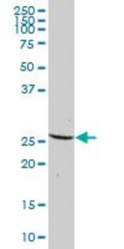 Anti-DCTN6 antibody produced in mouse IgG fraction of antiserum, buffered aqueous solution