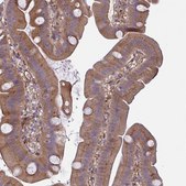 Anti-IFIT3 antibody produced in rabbit Prestige Antibodies&#174; Powered by Atlas Antibodies, affinity isolated antibody, buffered aqueous glycerol solution