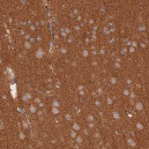 Anti-WDR41 antibody produced in rabbit Prestige Antibodies&#174; Powered by Atlas Antibodies, affinity isolated antibody, buffered aqueous glycerol solution