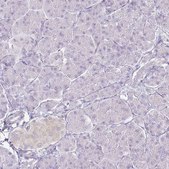 Anti-KCNH1 antibody produced in rabbit Prestige Antibodies&#174; Powered by Atlas Antibodies, affinity isolated antibody, buffered aqueous glycerol solution