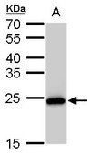Monoclonal Anti-SOD2 antibody produced in mouse clone GT582, affinity isolated antibody