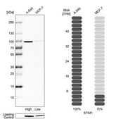 Anti-STIM1 antibody produced in rabbit Prestige Antibodies&#174; Powered by Atlas Antibodies, affinity isolated antibody, buffered aqueous glycerol solution