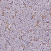 Anti-PSMB8 antibody produced in rabbit Prestige Antibodies&#174; Powered by Atlas Antibodies, affinity isolated antibody, buffered aqueous glycerol solution