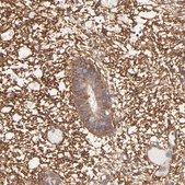 Anti-PTK7 antibody produced in rabbit Prestige Antibodies&#174; Powered by Atlas Antibodies, affinity isolated antibody, buffered aqueous glycerol solution