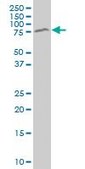 Monoclonal Anti-MECP2 antibody produced in mouse clone 1B11, purified immunoglobulin, buffered aqueous solution