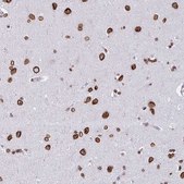 Anti-LMNB2 antibody produced in rabbit Prestige Antibodies&#174; Powered by Atlas Antibodies, affinity isolated antibody, buffered aqueous glycerol solution