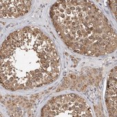 Anti-MTF1 antibody produced in rabbit Prestige Antibodies&#174; Powered by Atlas Antibodies, affinity isolated antibody, buffered aqueous glycerol solution, ab2