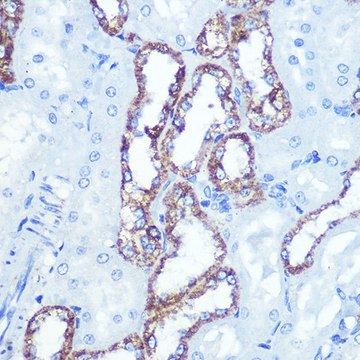 Anti- HK1 antibody produced in rabbit