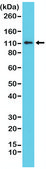 Anti-E-Cadherin (CDH1) antibody, Rabbit monoclonal recombinant, expressed in HEK 293 cells, clone RM244, purified immunoglobulin