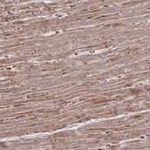 Anti-FUNDC2 antibody produced in rabbit Prestige Antibodies&#174; Powered by Atlas Antibodies, affinity isolated antibody, buffered aqueous glycerol solution