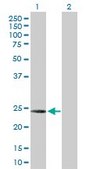 Anti-C1QC antibody produced in rabbit purified immunoglobulin, buffered aqueous solution
