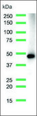 Anti-MAGE-A1 antibody, Rabbit monoclonal clone SP194, recombinant, expressed in proprietary host, affinity isolated antibody