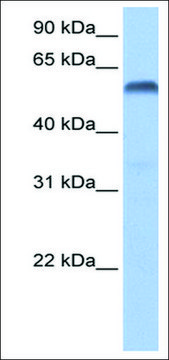 Anti-PAX3 antibody produced in rabbit affinity isolated antibody