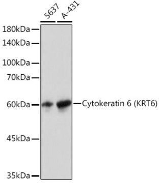 Anti-Cytokeratin 6 (KRT6) Antibody, clone 1T4Z8, Rabbit Monoclonal